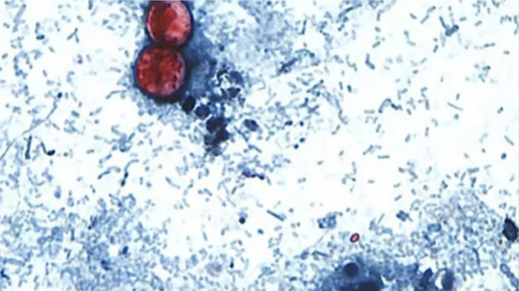 Michigan Cyclosporiasis Cases Near 1,000 as Health Officials Continue Searching for the Contaminated Produce Linked to the Outbreak